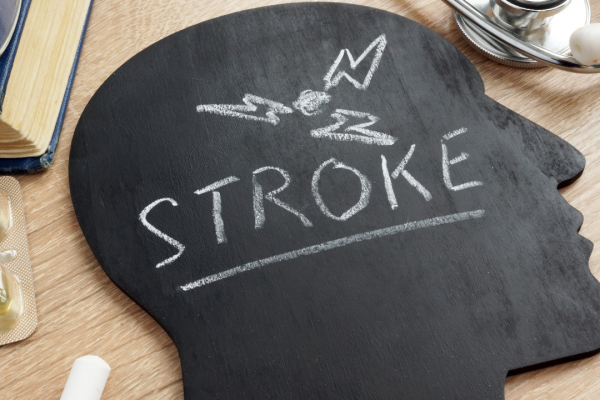 Cara Mencegah dan Mengobati Stroke